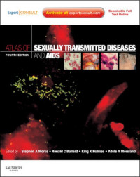 Image of Atlas of Sexually Transmitted Disesases and AIDS